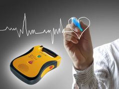 Obbligo defibrillatori: il termine slitta al 1 gennaio 2017